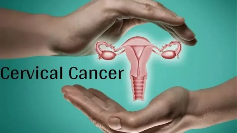 4 أسباب غير متوقعة تعرضك لسرطان عنق الرحم.. أعرفيها 