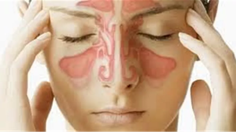 8 أعراض للالتهاب الجيوب الأنفية الحاد 