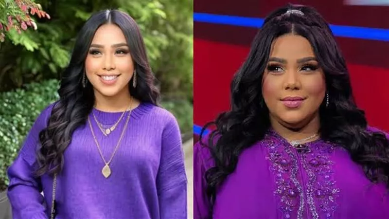 بعد شيماء سيف.. نجوم لجئوا لعمليات تكميم المعدة لإنقاص الوزن