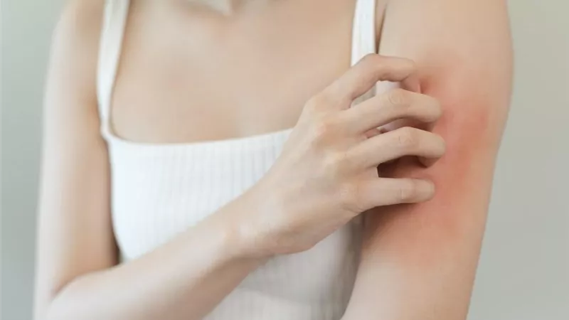6 أطعمة تحارب الالتهابات والحساسية.. احرصٍ على تناولها 