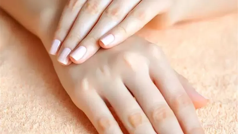 للجنس الناعم.. 5 علاجات منزلية للتخلص من اسمرار اليدين بعد المصيف