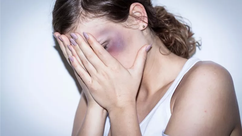 «زوجي يضربني باستمرار».. ماذا أفعل لأتخلص من عنفه؟ 