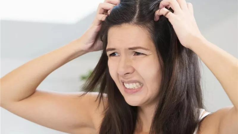 «لو بتعانى من حكة الرأس بكثرة».. إليك بعض العلاجات الطبيعية للتخلص منها 