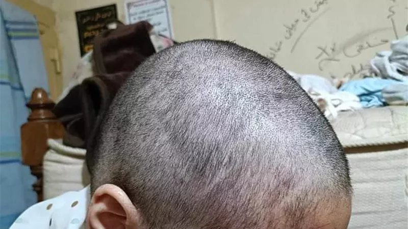  عذبوها وحلقوا شعرها.. تفاصيل تعرض فتاة للتعذيب على يد والدها وشقيقها 