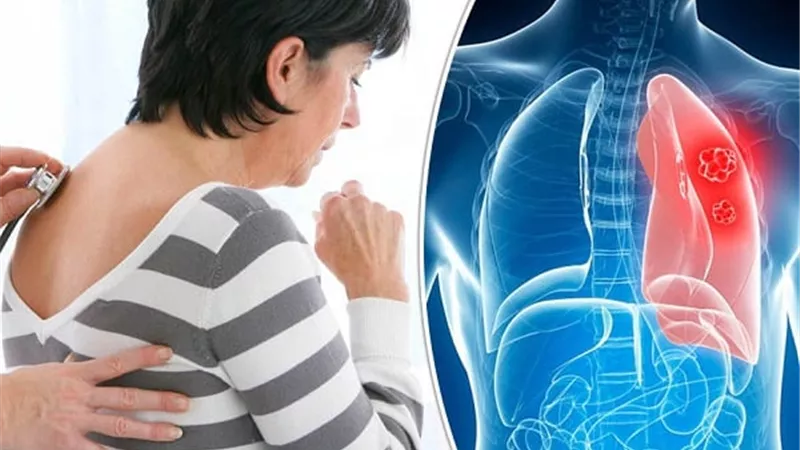في اليوم العالمي للرئتين.. الصحة تكشف 7 أعراض تنبأ بـ سرطان الرئة