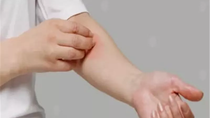 أسباب مرض التهاب الجلد الدهني وأعراضه وطرق علاجه