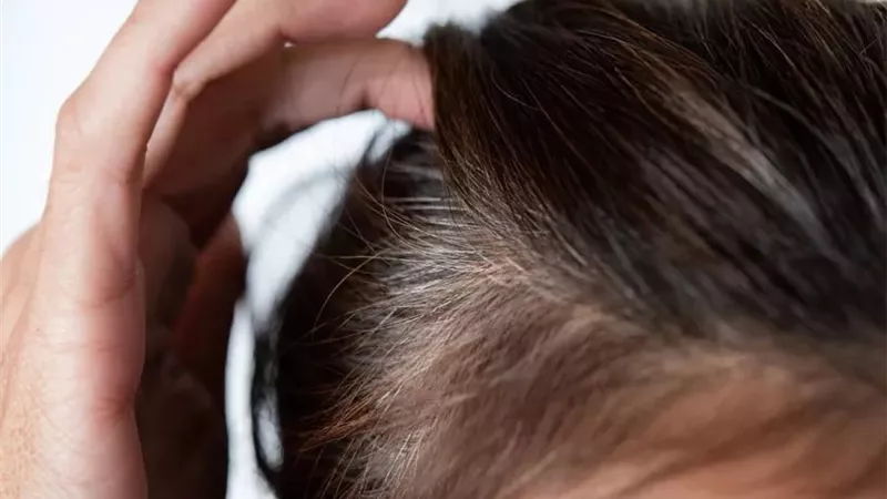 هل تعانين من الشيب المبكر؟.. السبب هذا الفيتامين 