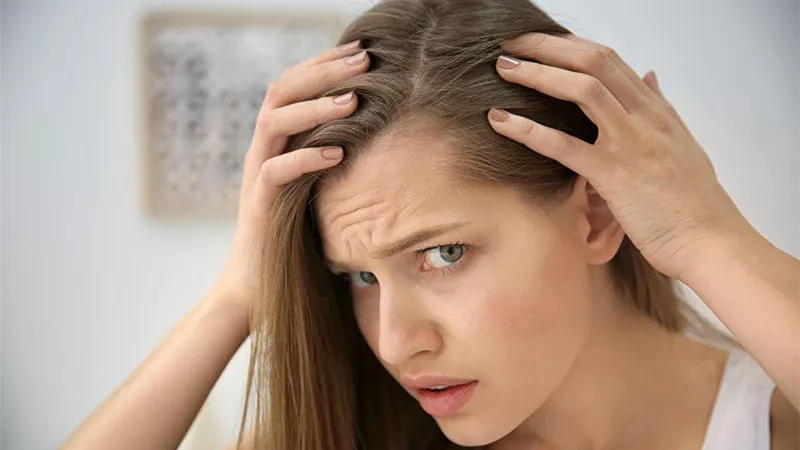 4 علاجات طبيعية للتخلص من قشرة الرأس