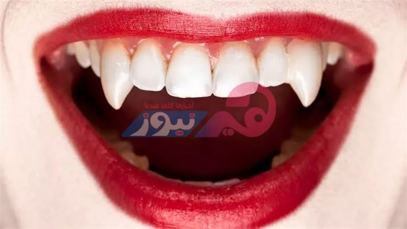مع اقتراب الهالوين.. تريند أنياب مصاصي الدماء يشعل الجدل عبر تيكتوك.. وأطباء أسنان يحذرون