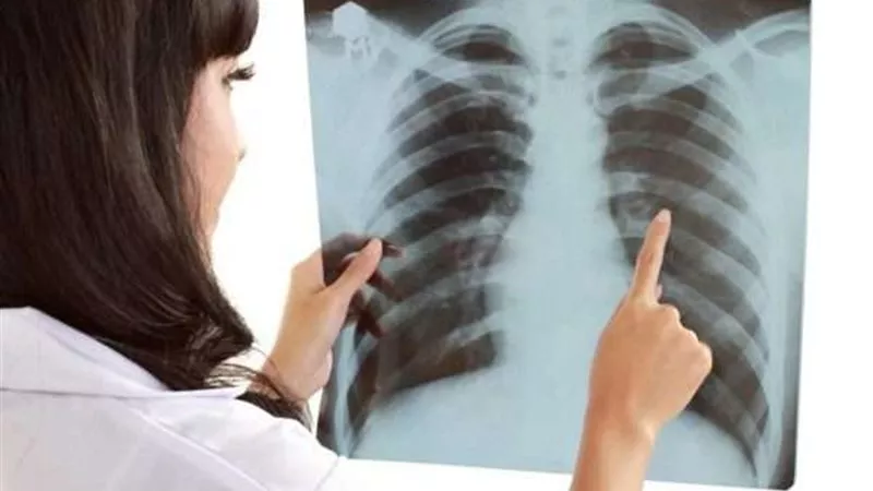 انتبه لهذه الأعراض.. قد تدل على الإصابة بسرطان الرئة