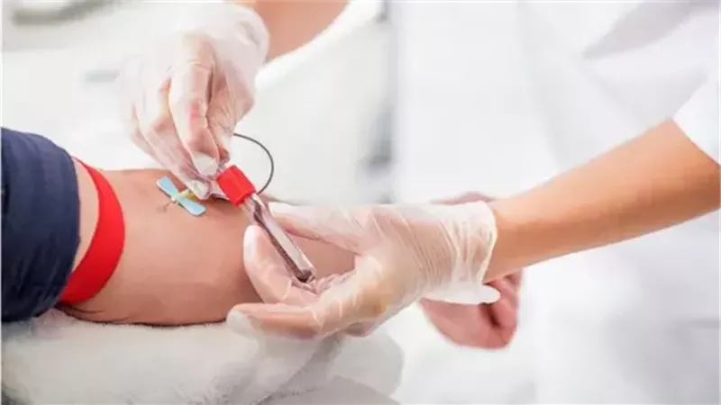 في اليوم العالمي للمتبرعين بالدم.. تعرف على ما هي شروط التبرع؟