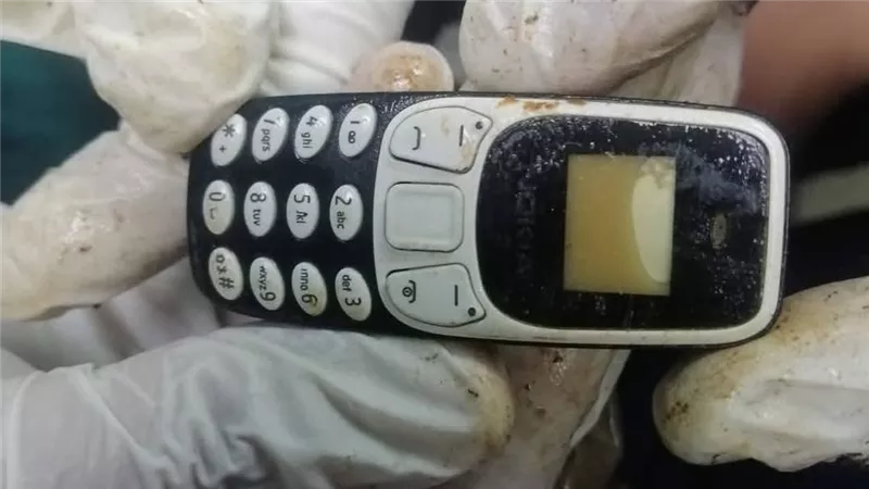 بعد عامين في المعدة.. فريق طبي بجامعة الأزهر بأسيوط ينجح في استخراج هاتف محمول من مريض دون جراحة