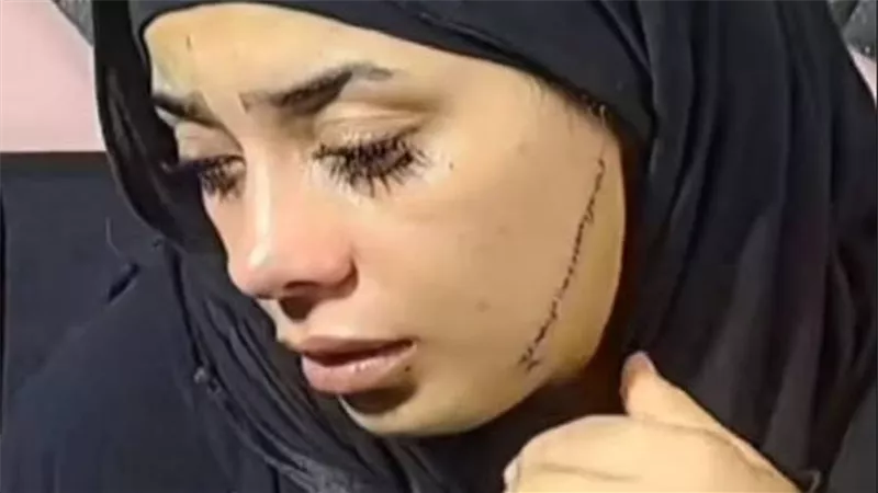 فتاة مصر القديمة ضحية انتقام عاطفي… 41 غرزة تنقذ حياتها