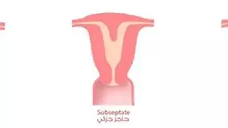 الحاجز الرحمي.. كيف يؤثر على الحمل والولادة.. وأسبابه وطرق العلاج 