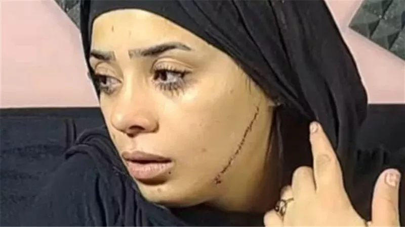 محكمة جنايات القاهرة تنظر أولى جلسات محاكمة المتهمة بتشويه وجه عروس مصر القديمة