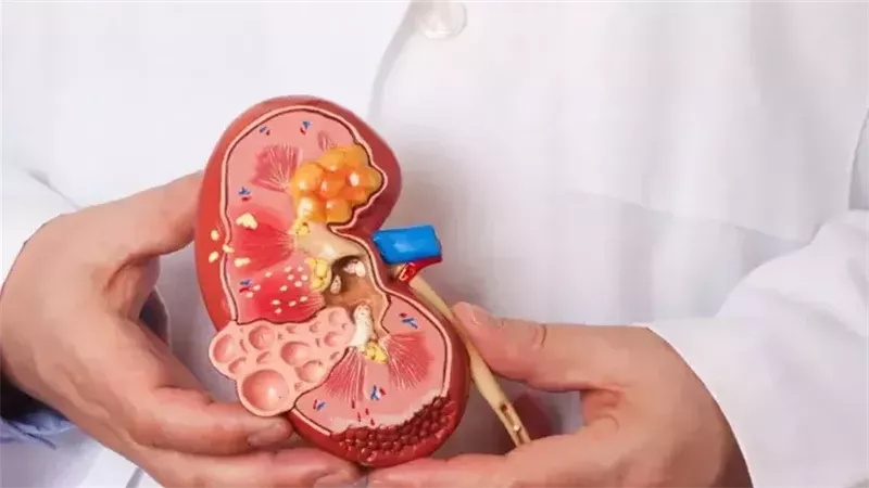 الصحة توجه إرشادات لمرضى القلب والكلى لصيام آمن في رمضان: استشارة الطبيب أساسية