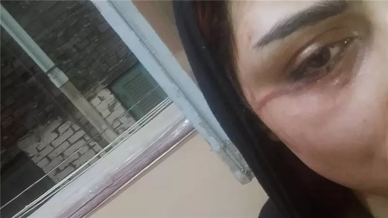 سيدة تستغيث بوزارة الداخلية: «تعرضت للاعتداء من زوجي وطُردت من منزلي»