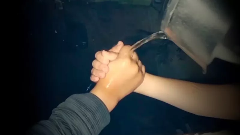 مخاطر و حروق بالغة..تريند 