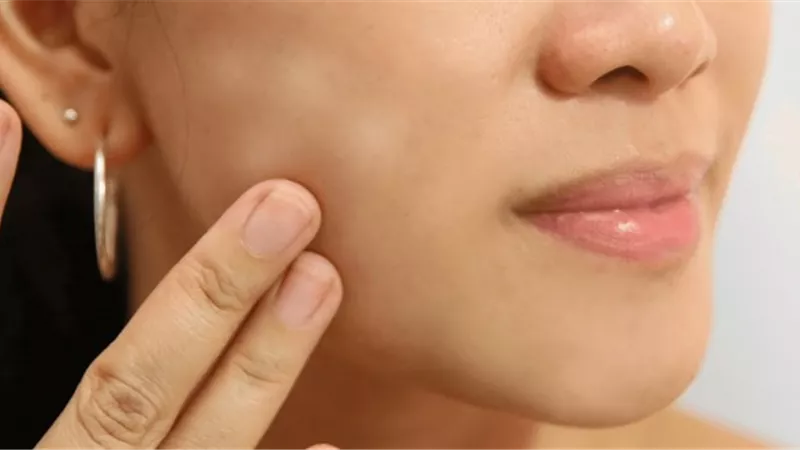 9 أسباب للإصابة بمرض نقص التصبغ لدى الفتيات.. احذريها