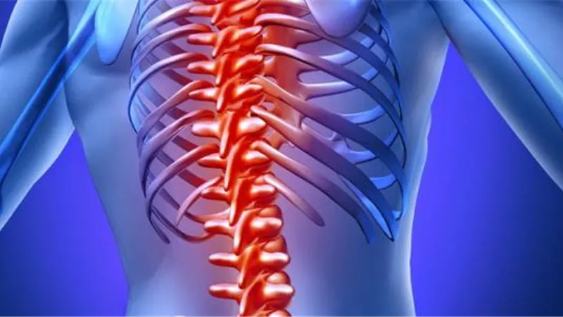 8 أعراض للإصابة بالانزلاق الغضروفي للفتيات.. واستشاري يوضح طرق الوقاية