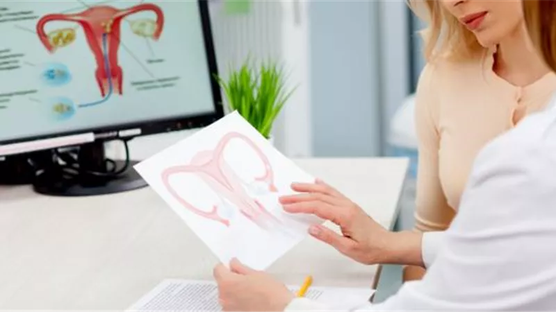 تُصاب به 75% من السيدات.. أعراض وعلاج أورام الرحم الليفية