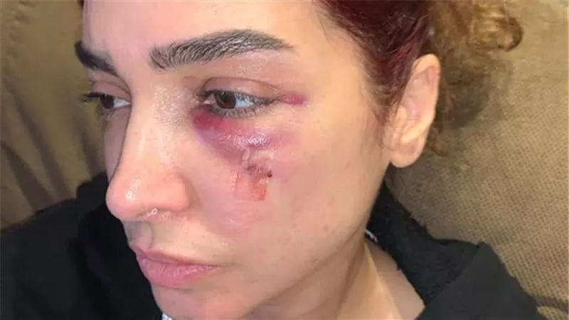 7 غرز من فعل «بنت السلطان».. آخر تطورات الحالة الصحية لـ روجينا