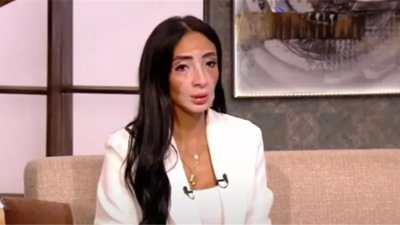 لوجينا صلاح متحدية البهاق: تركت عملي في البنوك ولجأت للتجميل والسوشيال