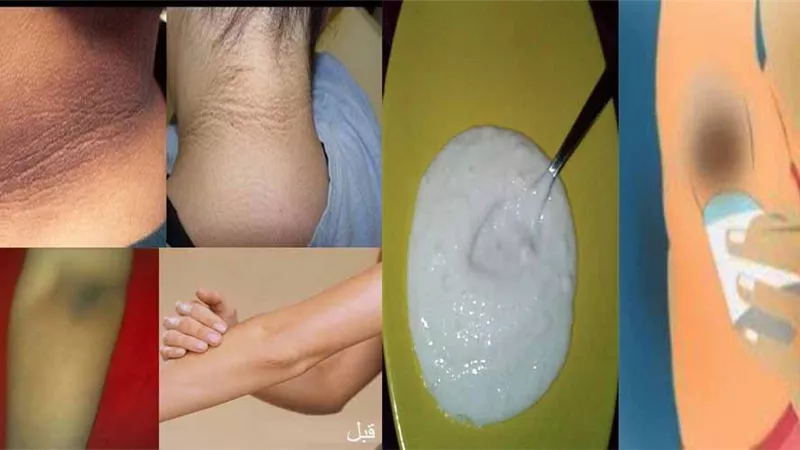 للمقبلات على الزواج.. 5 وصفات طبيعية لتفتيح المناطق الحساسة