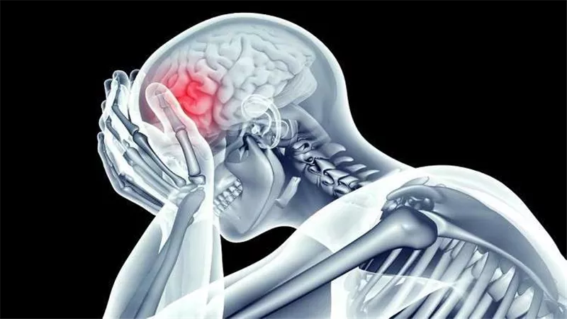 علامات تُحذرك من خطورة الإصابة بسكتة دماغية 