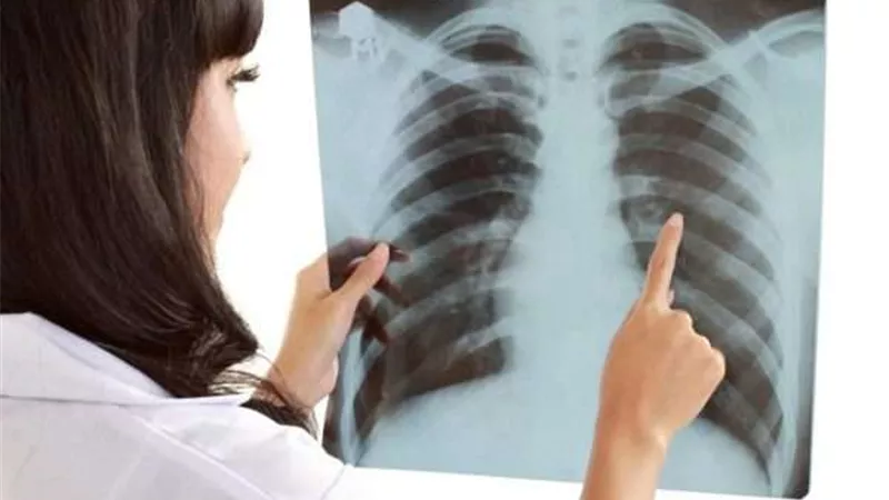 منها فقدان الوزن.. 7 أعراض مبكرة لسرطان الرئة عند النساء