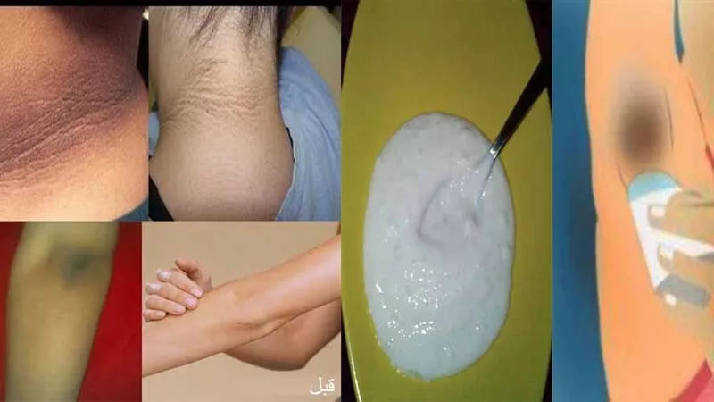 5 وصفات طبيعية لتفتيح المناطق الحساسة شديدة السواد