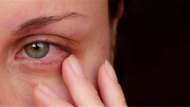 4 علامات تحذيرية مبكرة لاعتلال الشبكية السكري