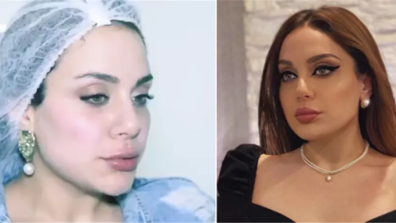 جدل على السوشيال ميديا بسبب أنف ابنة هيفاء وهبي 