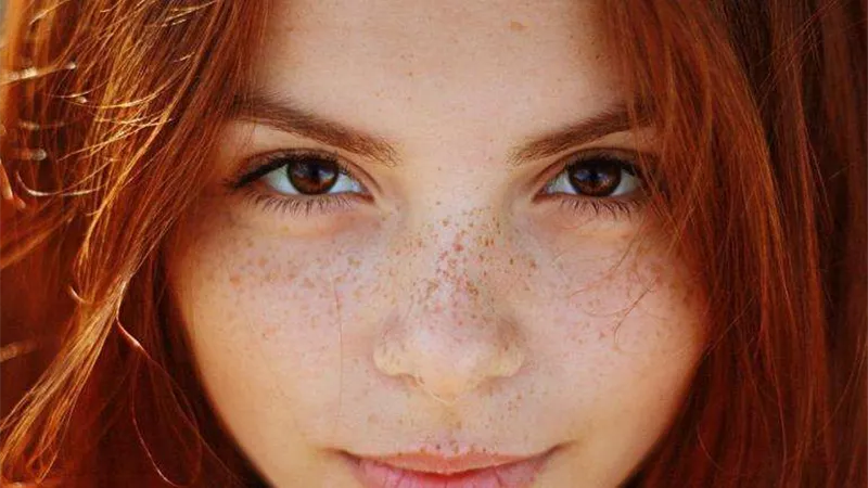 كريمات تساعدك على علاج النمش من وجهك