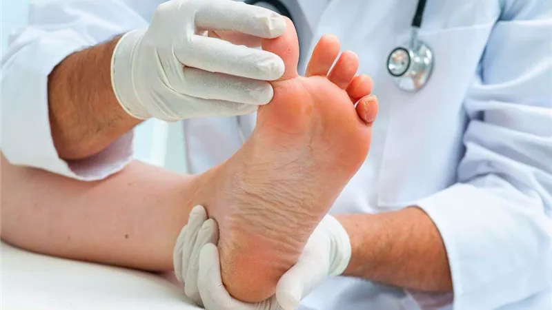 «كمادات النعناع والبقدونس».. 5 وصفات طبيعية لعلاج قرحة القدم