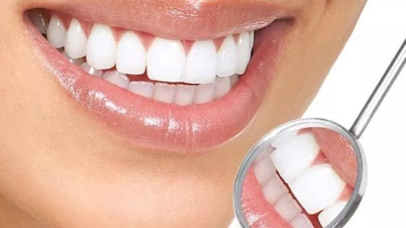 5 وصفات طبيعية لعلاج التهاب اللثة في المنزل 