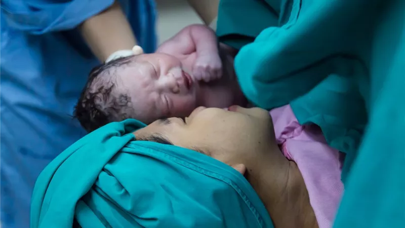 موضة الولادة القيصرية| من الجاني الزوجة أم الطبيب؟.. أمهات يروين تجاربهن