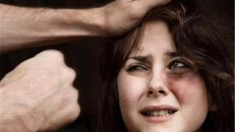 يشوه وجه زوجته لرفضها إنفاق أموالها على «مزاجه»