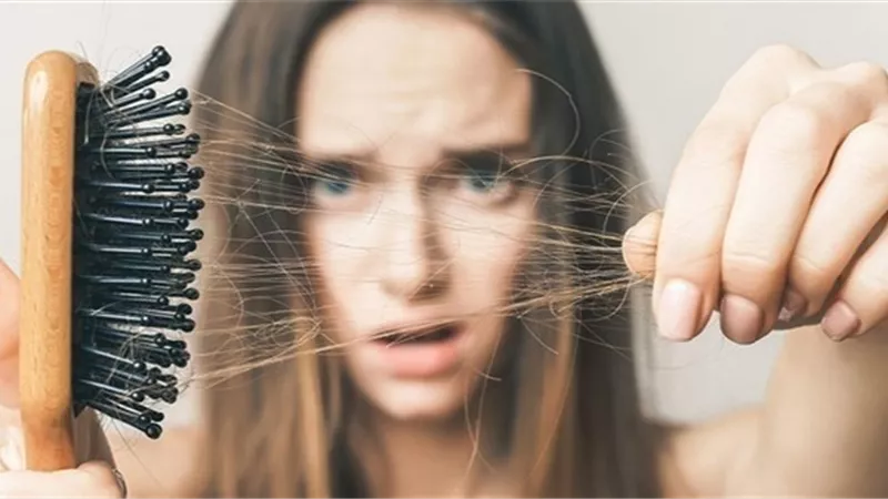 6 أسباب تؤدى إلى تساقط الشعر