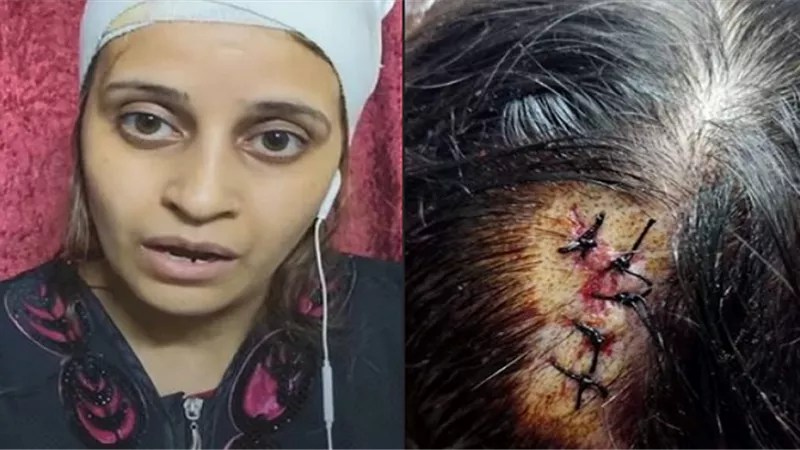 «في استجابة سريعة» الداخلية تُنقذ «ماري مجدي» ضحية العنف الزوجي| فيديو
