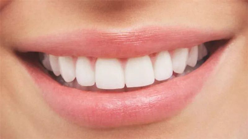 أسنانك سر جمالك.. كيف تحصلين على أجمل ابتسامة بأقل تكلفة؟