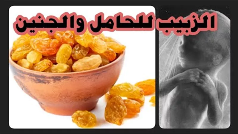 «أبرزهم علاج الغثيان» تعرفي على فوائد الزبيب المذهلة للمرأة الحامل