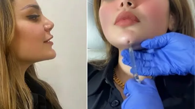 «مكتفتش بجمالها» ابنة هيفاء وهبي توضح تفاصيل خضوعها لجراحات تجميل