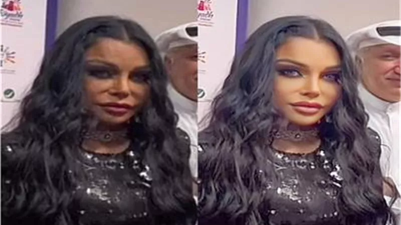 بعد ظهور مثير للجدل.. حقيقة تشوه وجه هيفاء وهبي بسبب عمليات التجميل
