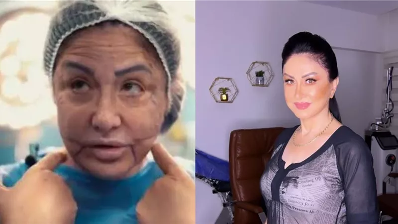 تطورات الحالة الصحية لـ وفاء سالم بعد خضوعها لعملية تجميل