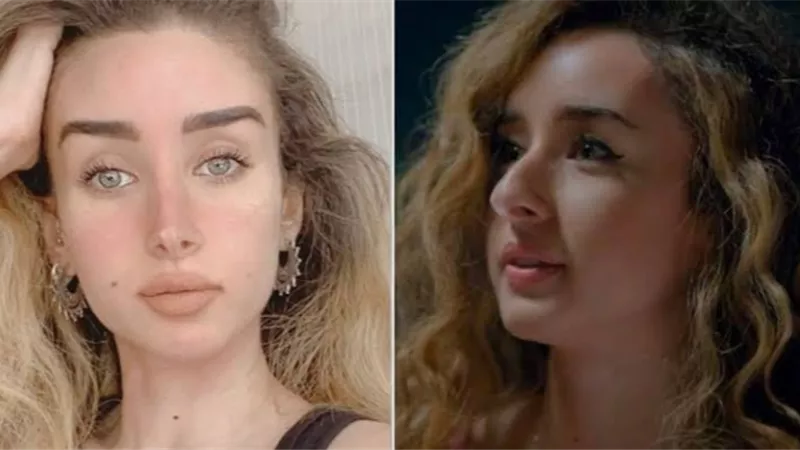 بعد تصدرها التريند .. تعرفي على عدد عمليات التجميل التي خضعت لها هنا الزاهد
