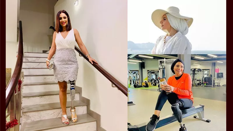 نساء ملهمات.. «زينب العقبي» شظية قنبلة أفقدتها ساقها فصارت مقدمة برامج مشهورة  
