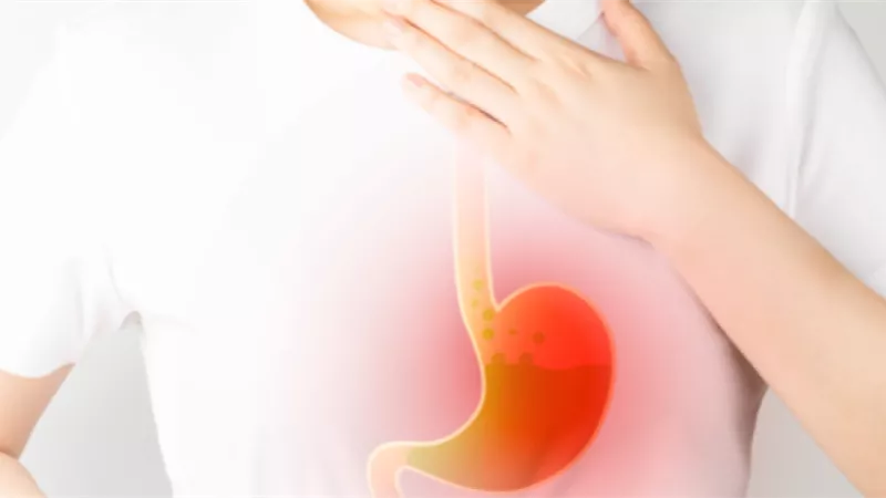 عادات غذائية تساعدك في علاج ارتجاع المريء.. تعرفي عليها