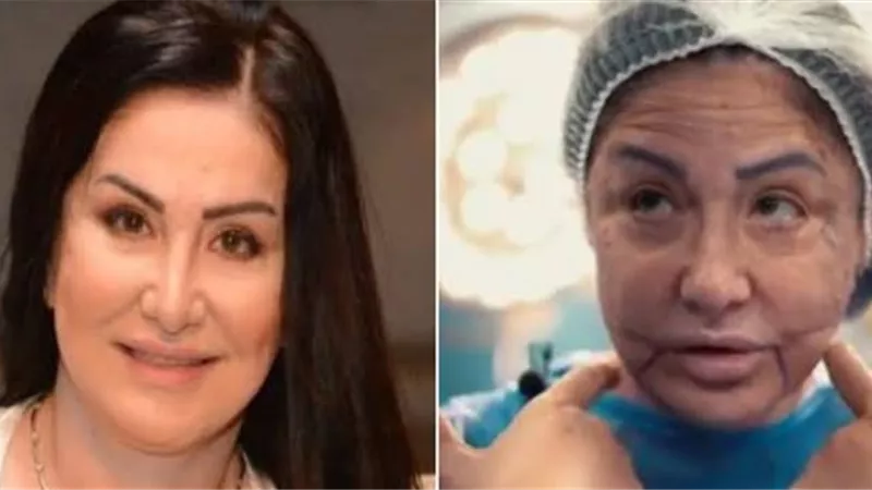 وفاء سالم عن عمليات التجميل: «مكنتش طايقة أبص لنفسي»