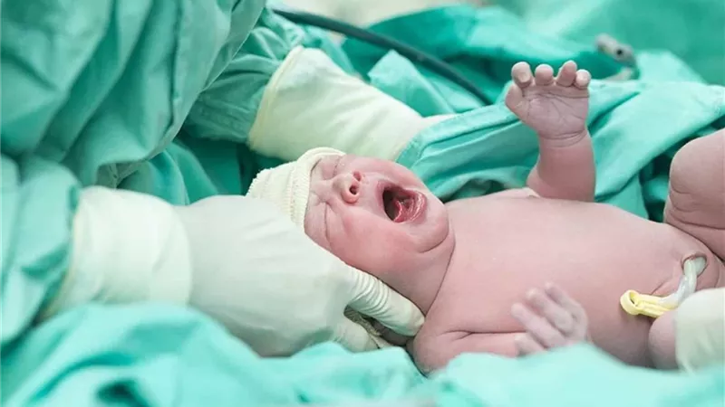 غرائب حالات الولادة| طفل تونسي يحمل شقيقه التوأم في بطنه 